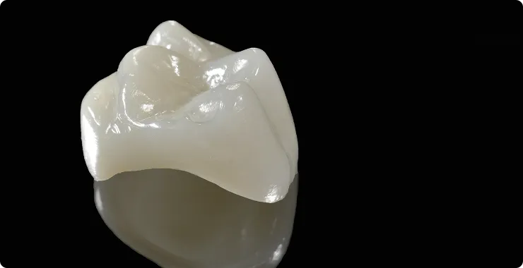 保険適用の白い歯イメージ